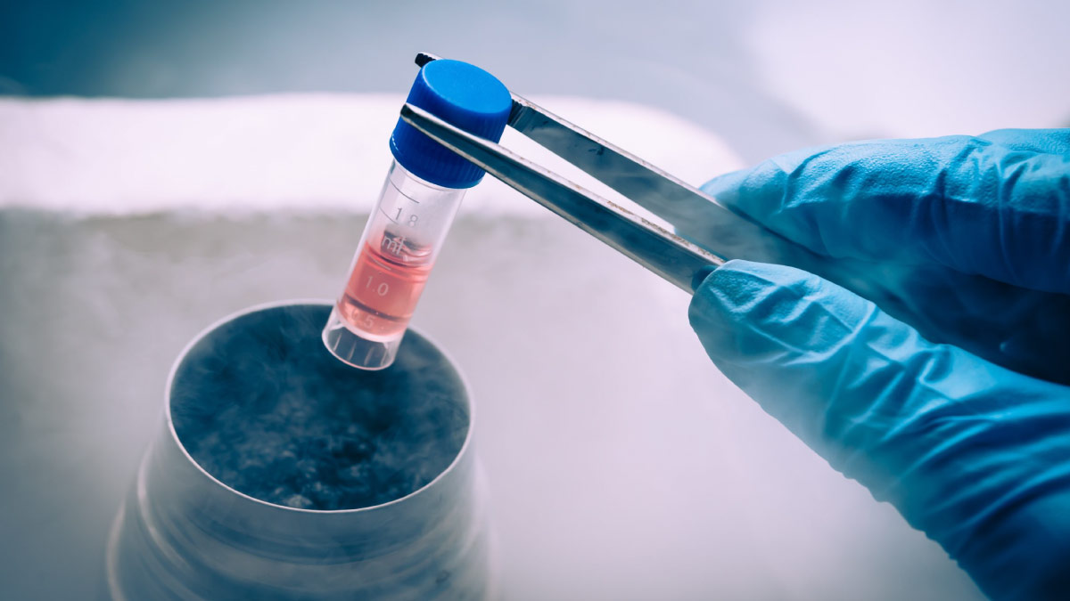 Fazer criopreservação de células estaminais: Sim ou não?
