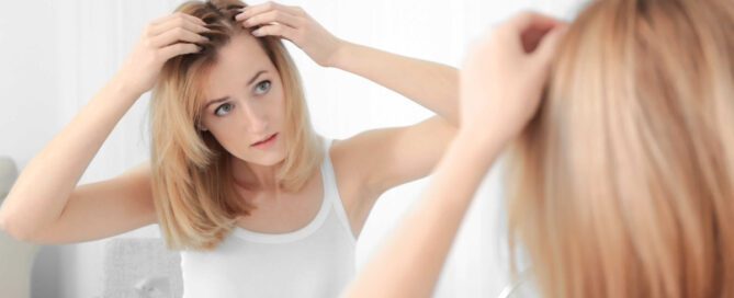 alopecia