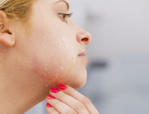 Cremes para pele seca: 5 Essenciais para cuidar de si
