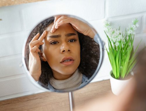 Pele oleosa: Como controlar o brilho e prevenir borbulhas